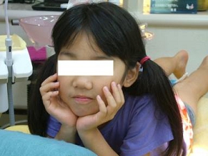 きたのさわ夜間歯科・矯正歯科の噛みあわせバランスの矯正のページ。普段、家庭や学校でしている態癖:頬杖の再現をしてもらいました。かみ合わせの不具合が起こりますが、当院の専門的な歯列矯正により元の咬合バランスに戻すことが出来ます。