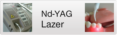 ここからは札幌南区の北の沢きたのさわ夜間歯科・矯正歯科のYAGレーザー歯科・歯周治療の紹介ページにいきます。