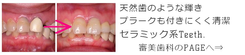 審美歯科の紹介リンク