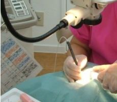 レーザー治療法。術者がレーザー照射している写真。